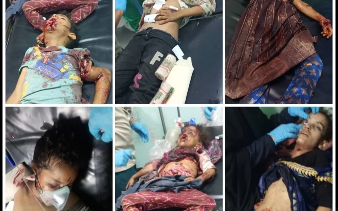 الشبكة المدنية تدين مقتل وإصابة (ثلاثة عشر طفلاً) بإنفجار مقذوف حوثي من مخلفات الحرب في محافظة الضالع | بيان